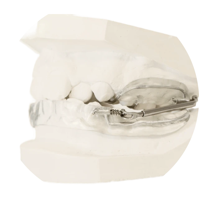 Activateur de croissance Cabinet dentaire du Dr Matthieu Soto à Miramas