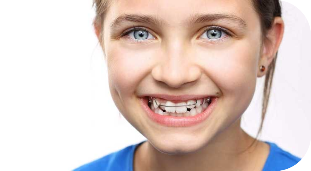 Activateur de croissance Cabinet d’orthodontie du Dr Matthieu Soto à Miramas