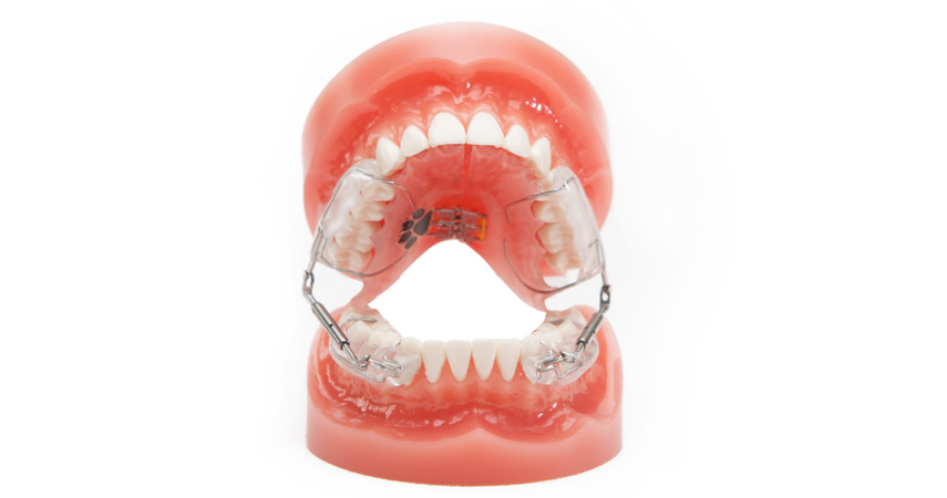 activateur croissance dr soto expert Activateur de croissance Cabinet dentaire du Dr Matthieu Soto à Miramas