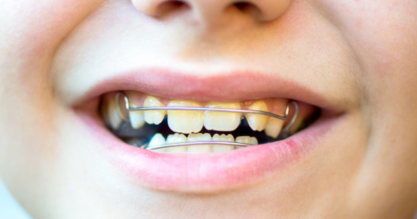 activateur croissance miramas soto Activateur de croissance Cabinet dentaire du Dr Matthieu Soto à Miramas