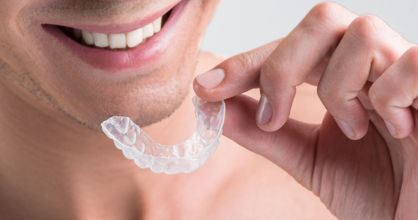 Aligneurs invisibles Cabinet d’orthodontie du Dr Matthieu Soto à Miramas