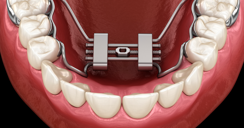 Comment activer son disjoncteur ? Cabinet dentaire du Dr Matthieu Soto à Miramas