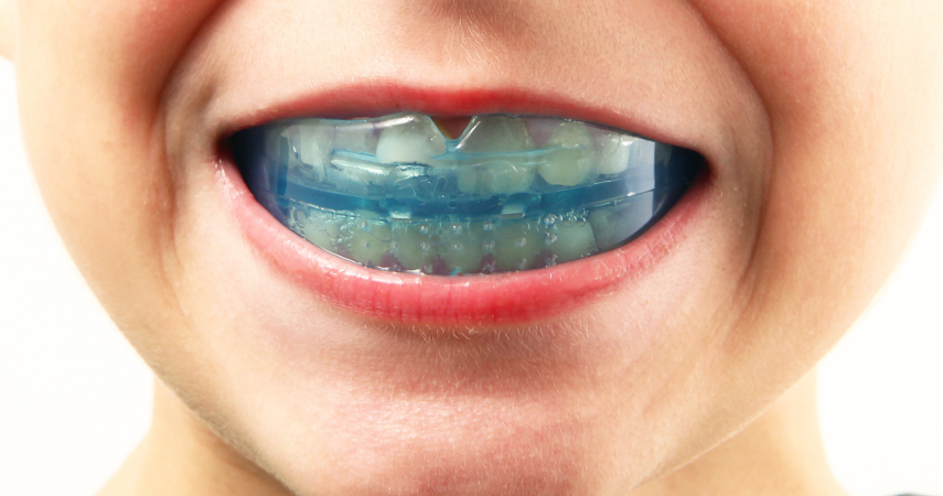 educateur fonctionnel dr matthieu miramas Éducateur fonctionnel Cabinet d’orthodontie du Dr Matthieu Soto à Miramas