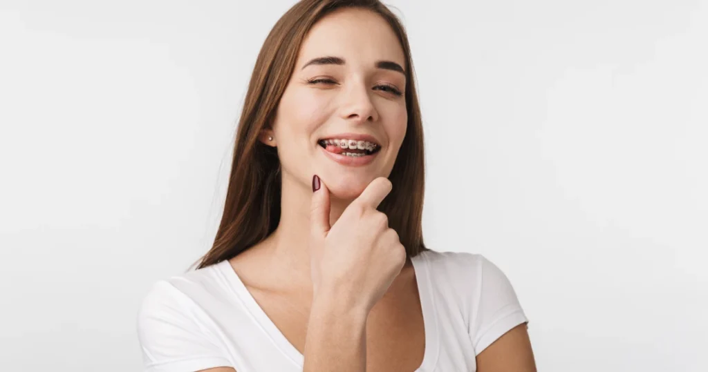 multi bagues docteur soto miramas Appareils dentaires en métal Cabinet d’orthodontie du Dr Matthieu Soto à Miramas