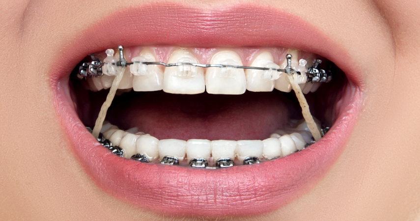 urgences dentaires matthieu soto miramas Incidents Cabinet d’orthodontie du Dr Matthieu Soto à Miramas