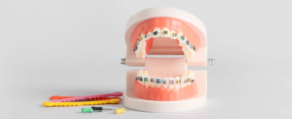 urgences orthodontiste matthieu soto Incidents Cabinet d’orthodontie du Dr Matthieu Soto à Miramas