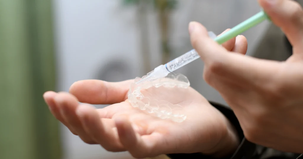 Éclaircissement dentaire Cabinet d’orthodontie du Dr Matthieu Soto à Miramas