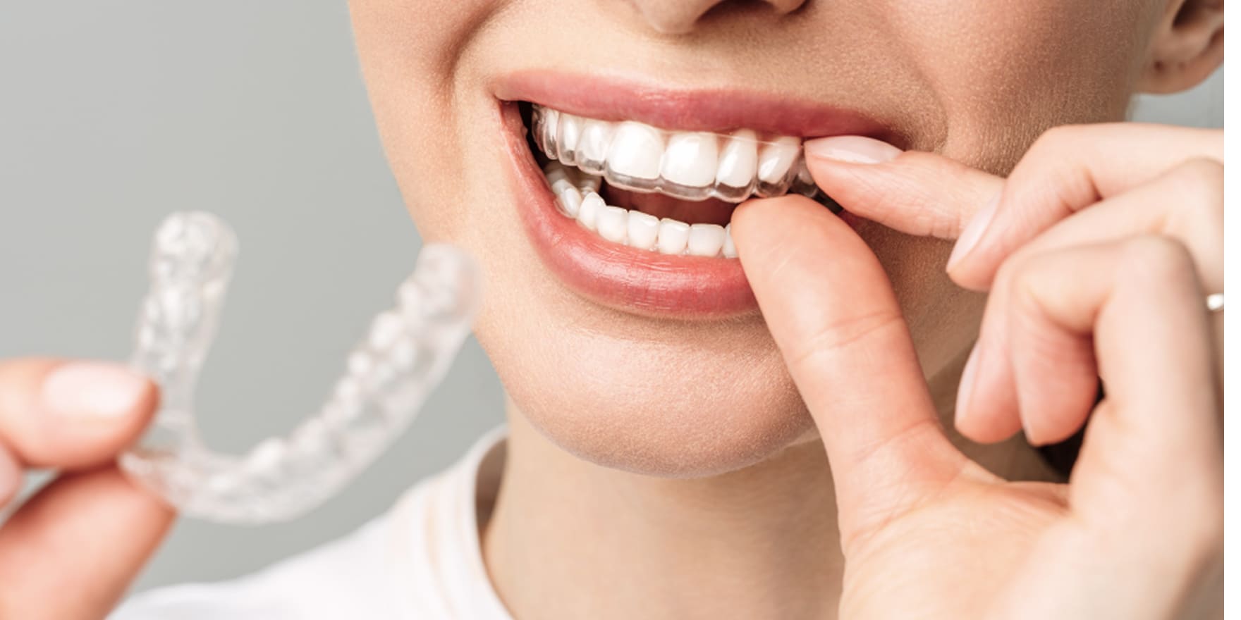 Accueil Cabinet d’orthodontie du Dr Matthieu Soto à Miramas